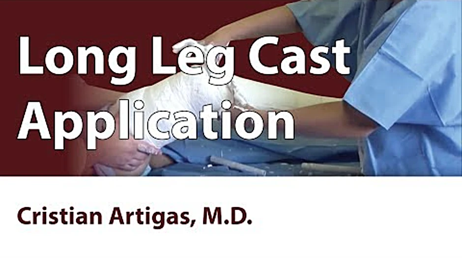 Long leg cast LLC registration